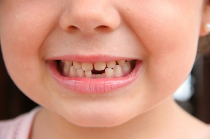 Treating a Dental Abscess in Children at the Pediatric Dental Center