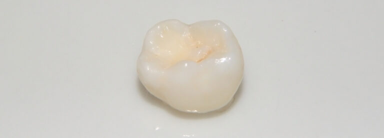 A single baby tooth on a white background.